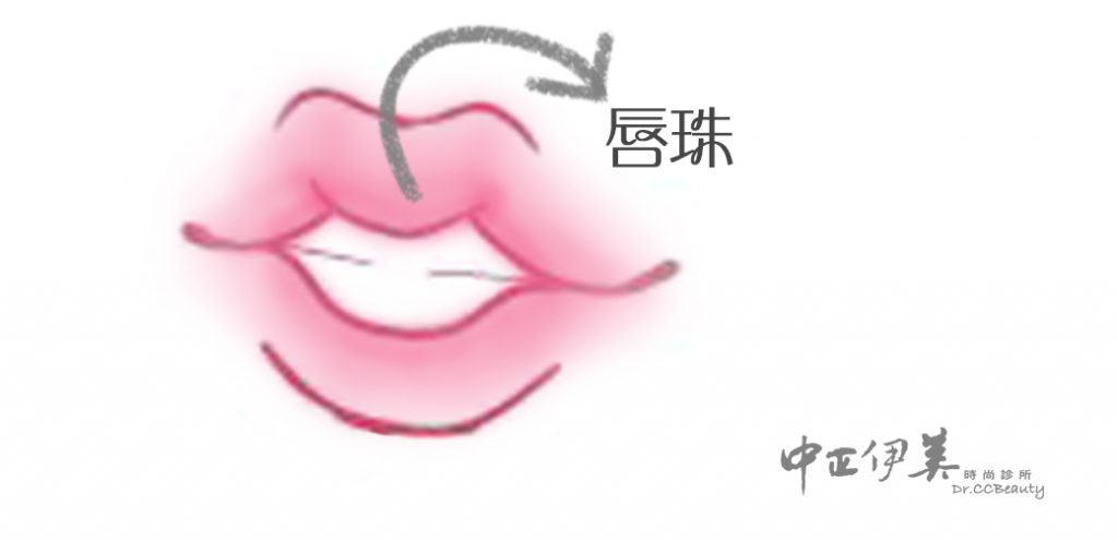 中正伊美M型唇珠 - 中正伊美時尚診所